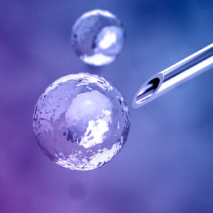 Stem cell therapy for MS patients