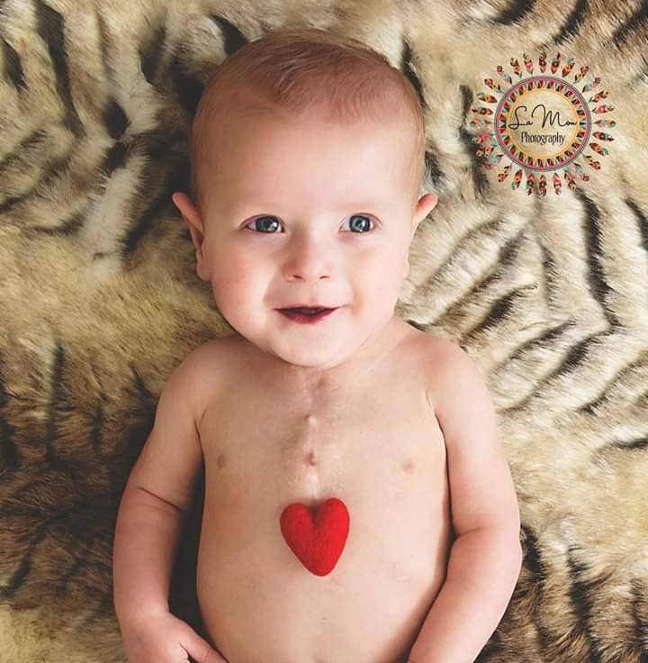 A world-first stem cell transplant for a tiny heart patient