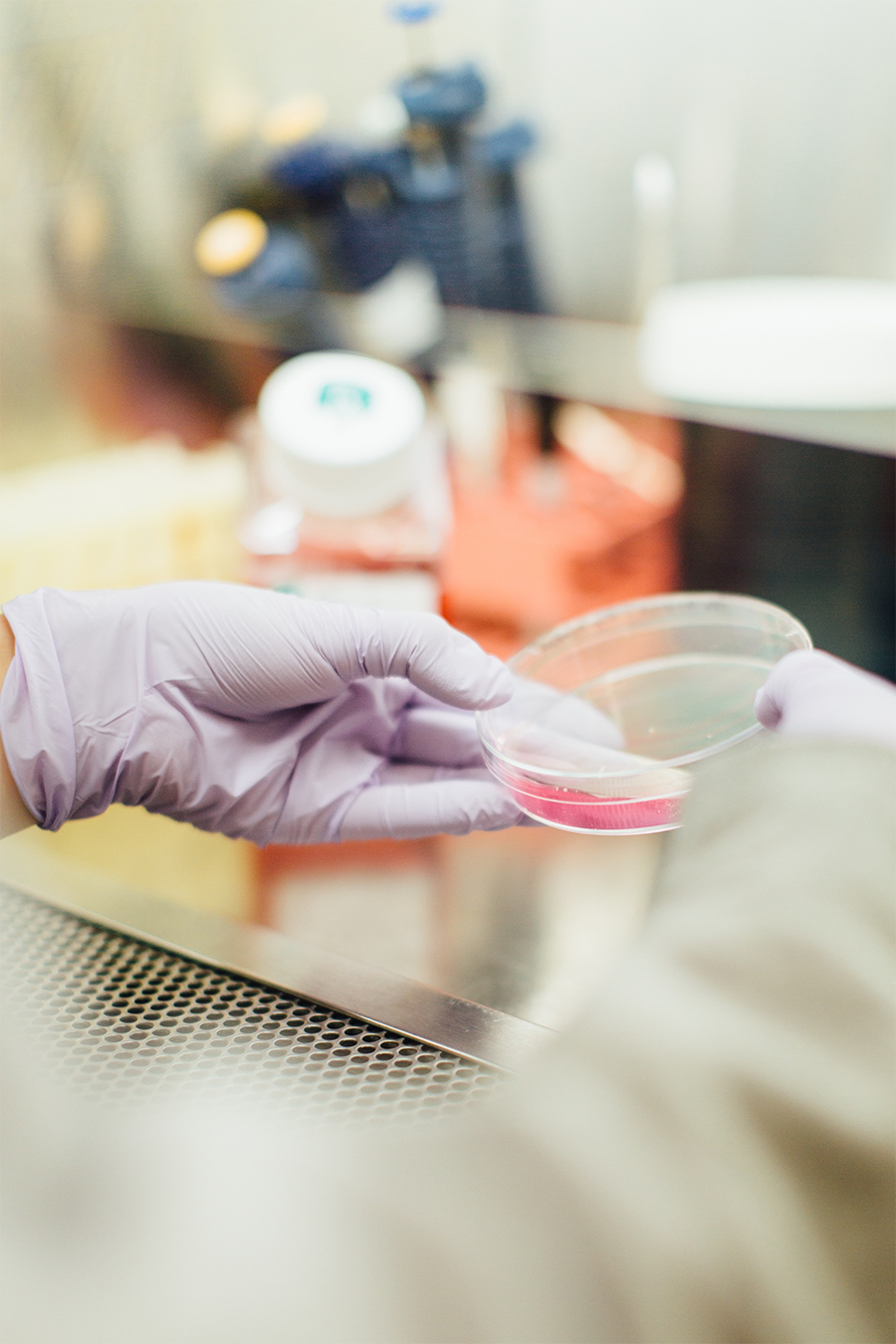 Can cord blood stem cells help stroke patients?