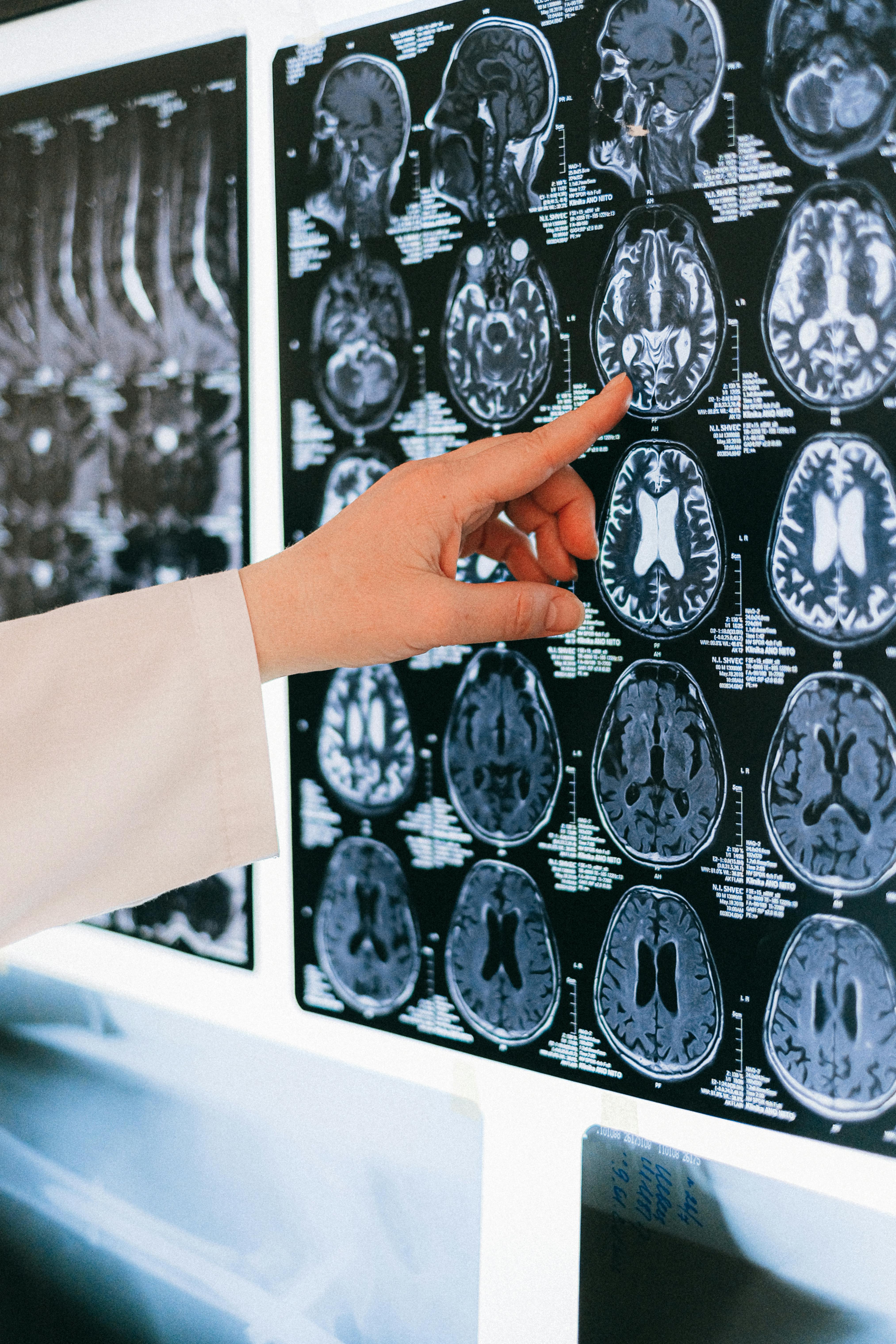 Brain Development Doesn’t Stop at 25