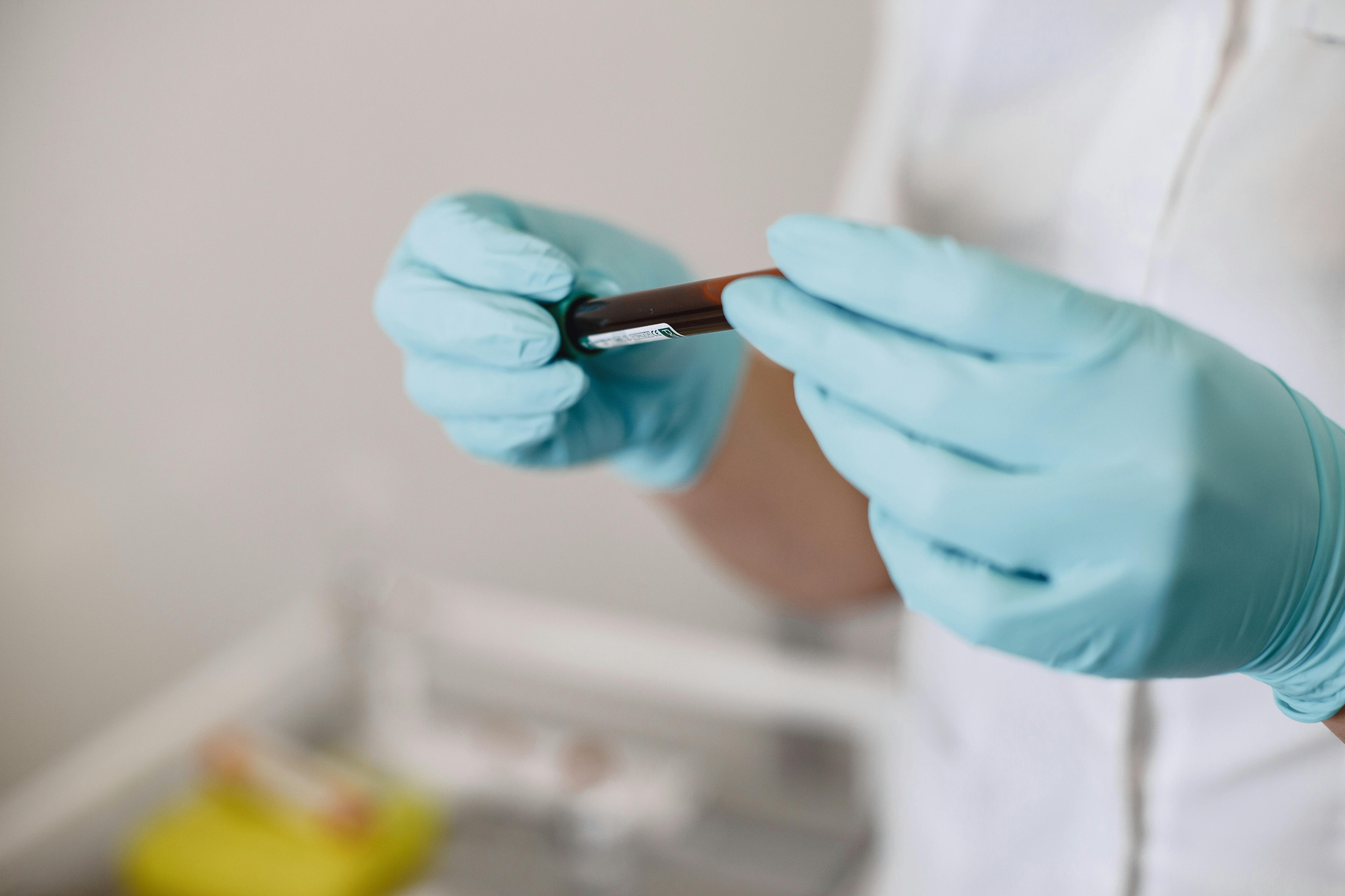 New Alzheimer’s study explores cord blood cells